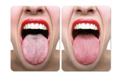 Desinfizierende Zungentropfen